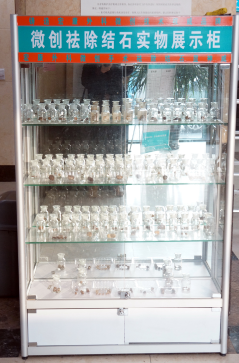 结石展示柜.png